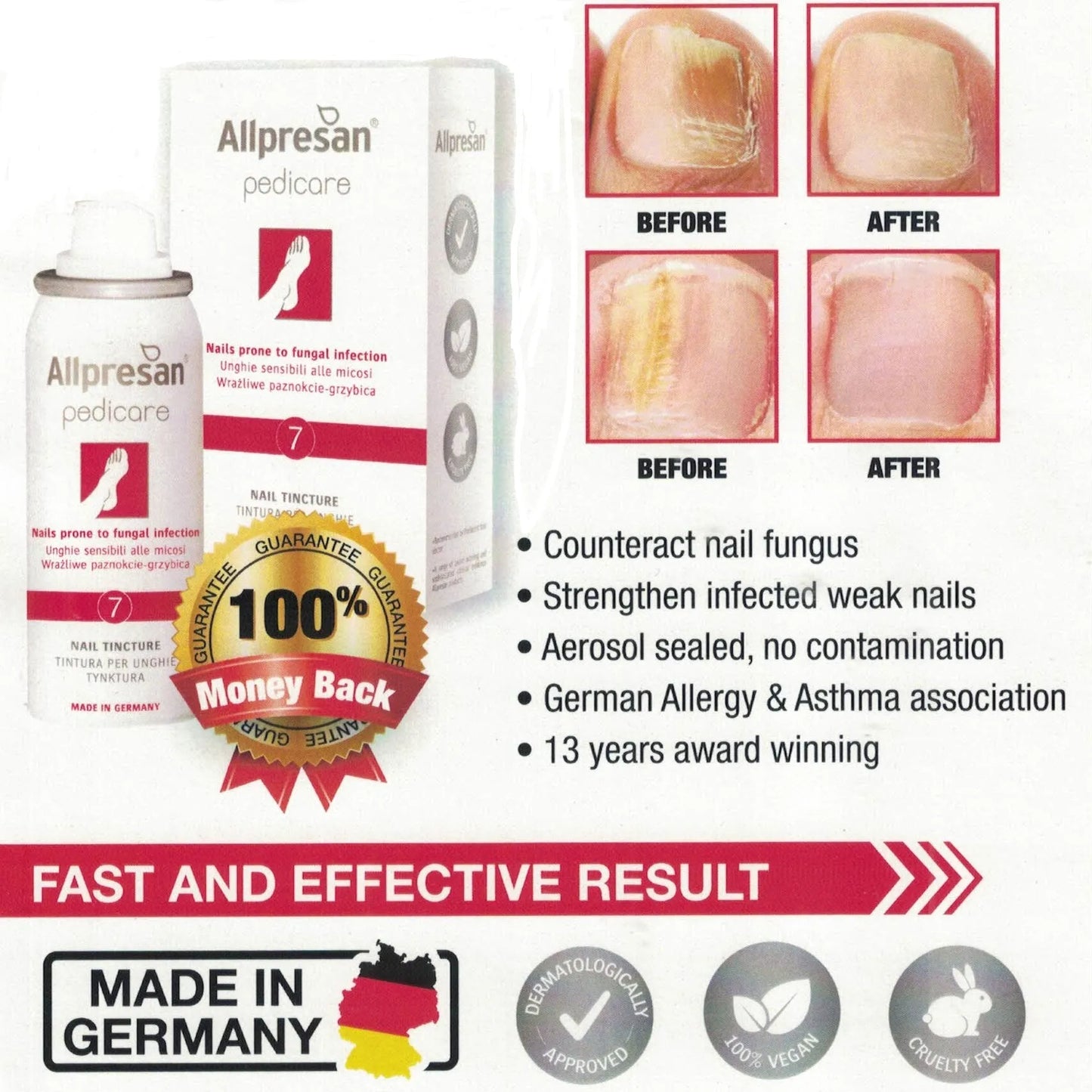 ALLPRESAN PEDICARE NO.7 NAIL TINCTURE